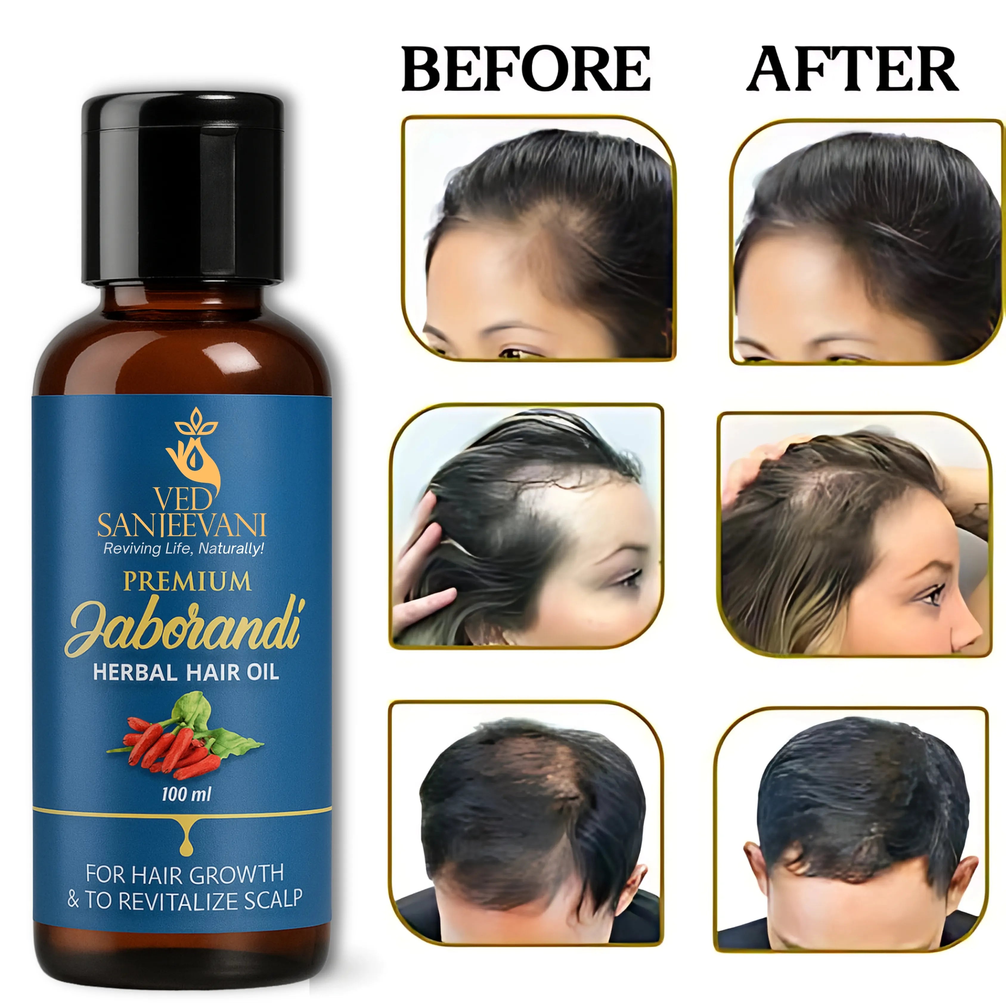 Premium Jaborandi Herbal Hair Oil –for Rapid Hair Growth
